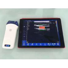 WiFi Connect Mini Handheld Portable Ultrasound Probe Wireless Ultrasound Scanner